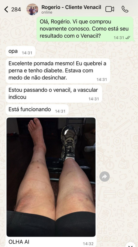 Print WhatsApp cliente creme para varizes