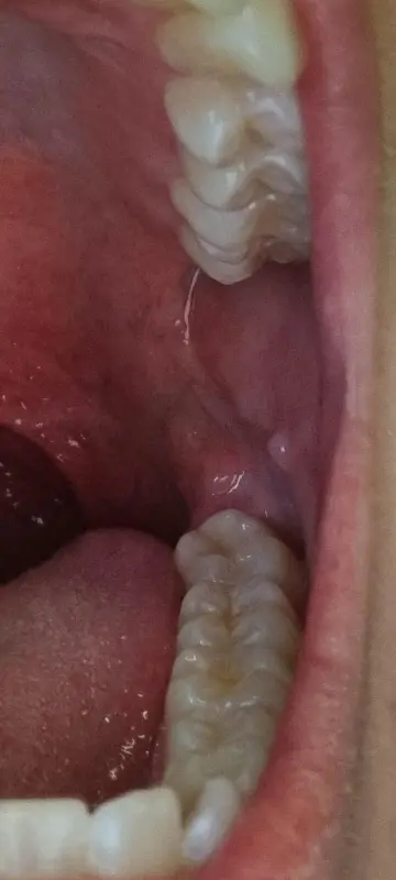 6-years-searching-for-diagnosis-just-found-multiple-v0-s68s2twdwyod1