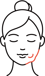 튀어나온 심부볼