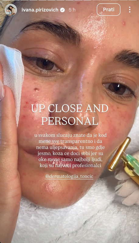 Screenshot 20251113 170504 Instagram