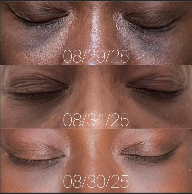 Before and After 2