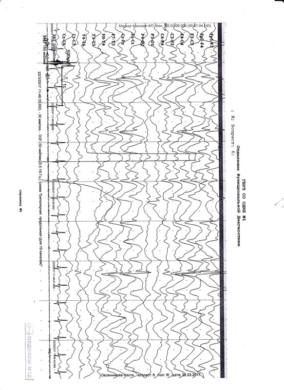 ЭЭг лист1 от 03.17