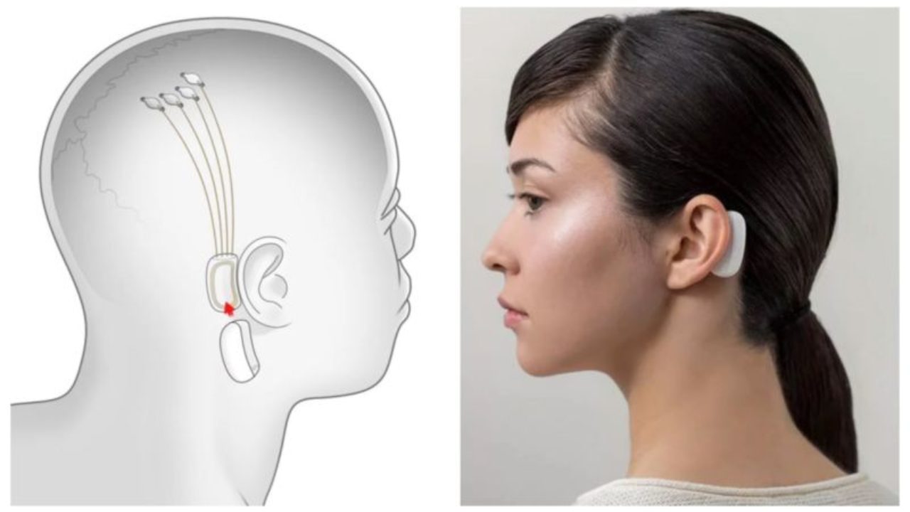 Neuralink alista sus primeras pruebas de chips cerebrales en humanos