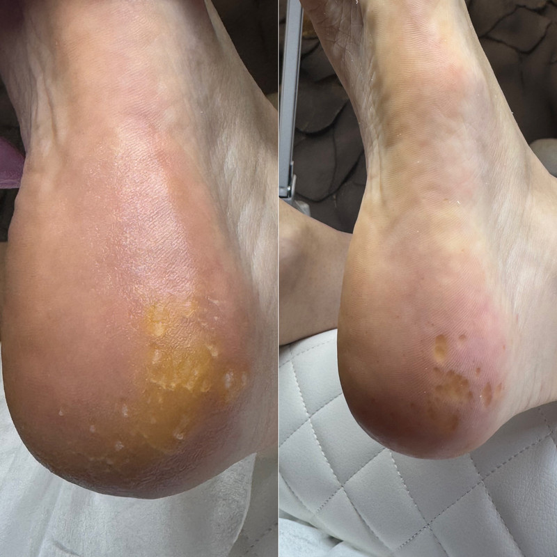 подология 2