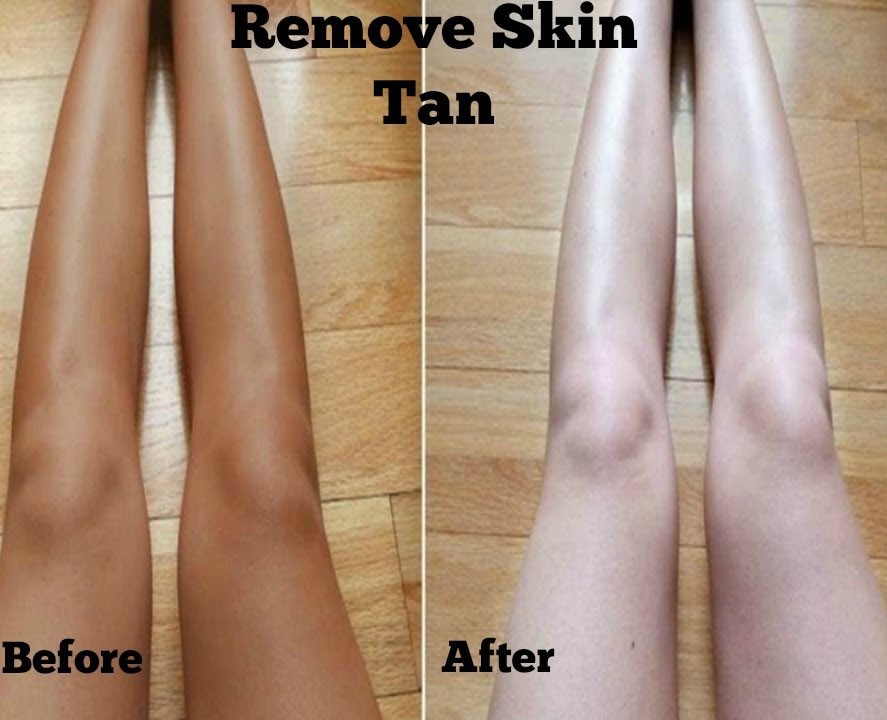 Remove Sun Tan