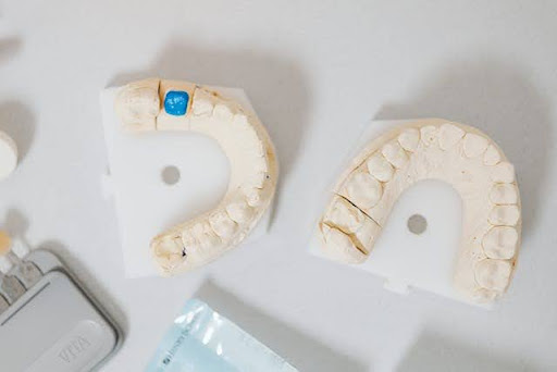 Invisalign vs Braces Comparison