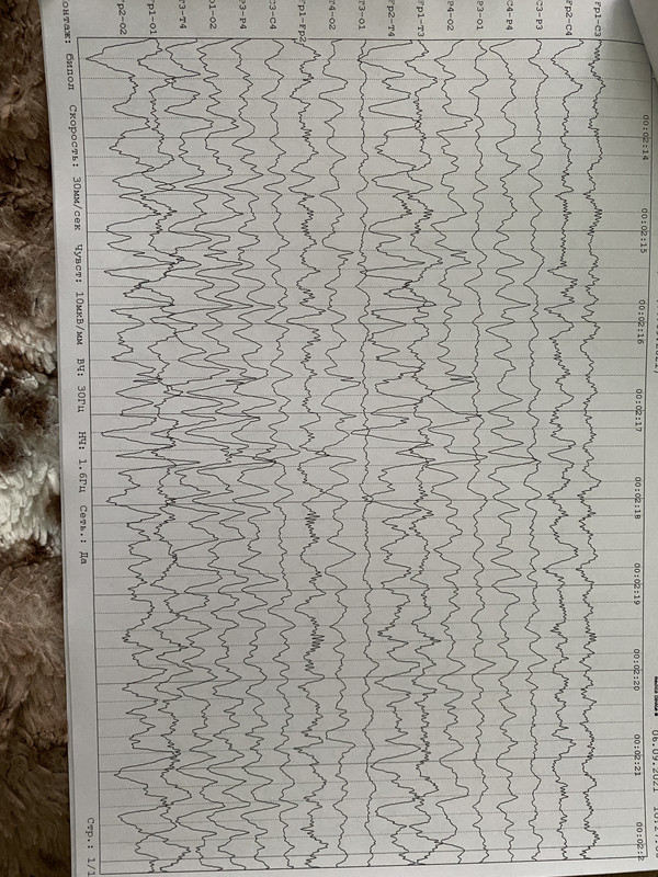 362AF3E1-06C3-4A88-BE7E-43A86EC9857D