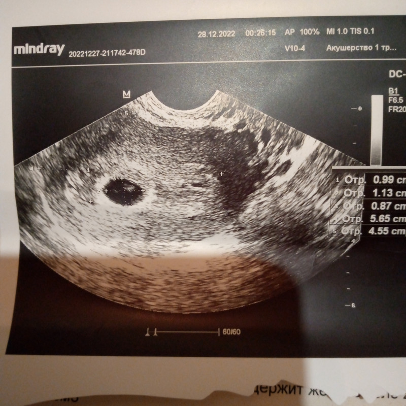 IMG_20221227_201621_476