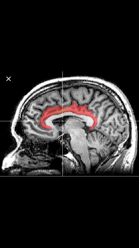 BACFD977-1FF0-40C8-B6A8-9BEDE862666C