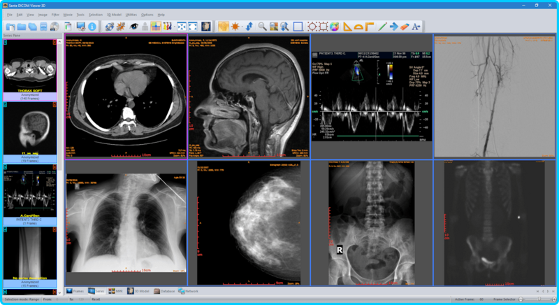 Sante-DICOM-Viewer-3-D-Pro-4-9-3.png