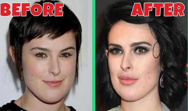 Las chicas hot - Página 4 Rumer-willis-before-and-after-plastic-surgery