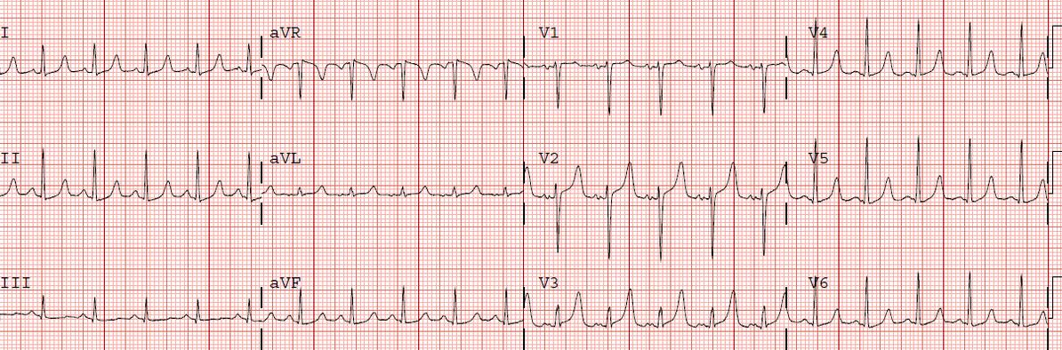 Orthopedics question 8 image