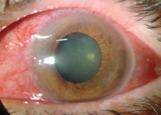 Ophthalmology question 2 image