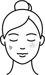 주근깨,흑자,잡티