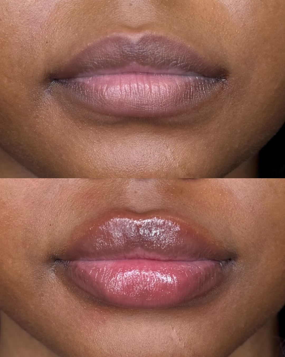 Lipparazzi Instant Filler Lips 5ML before and after