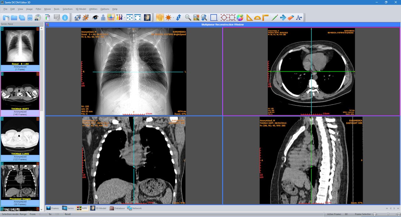 Sante DICOM Editor 3D 4.9.4