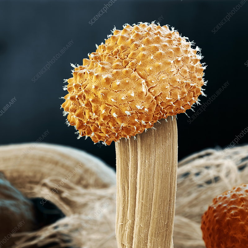 B2501235-Ergot_fungus,_SEM