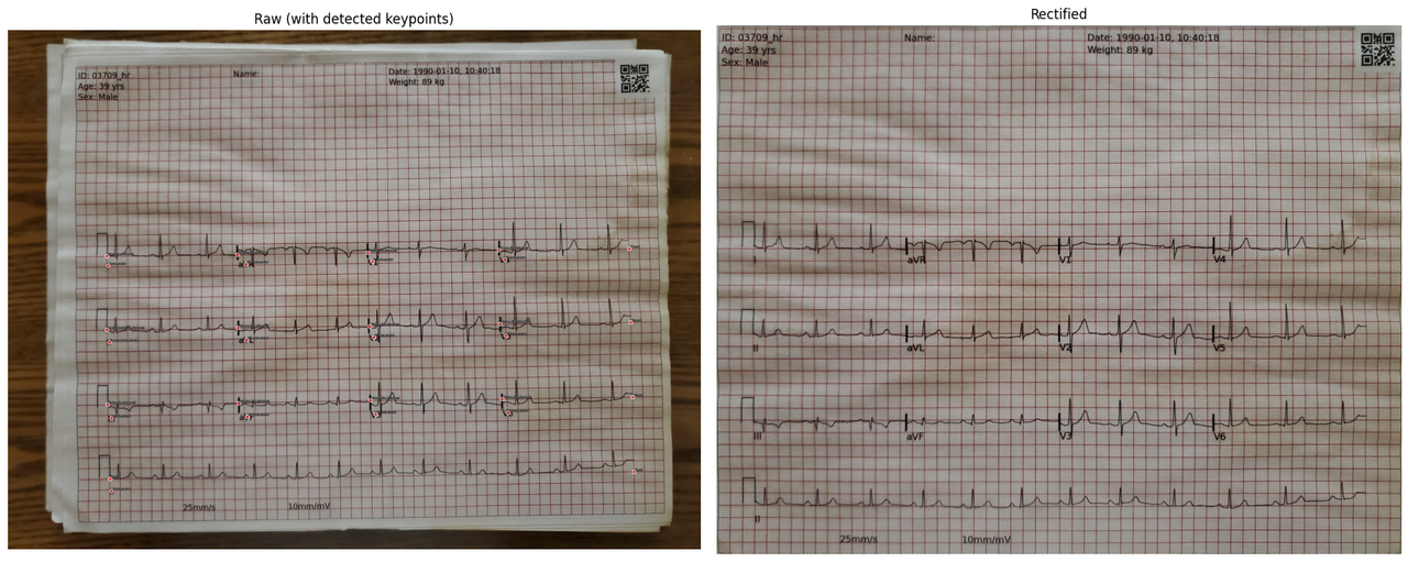 Figure 1: Sample ECG before and after perspective correction