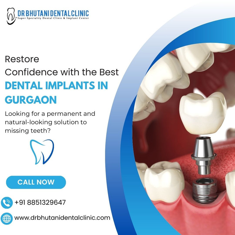 Dental implants in gurgaon