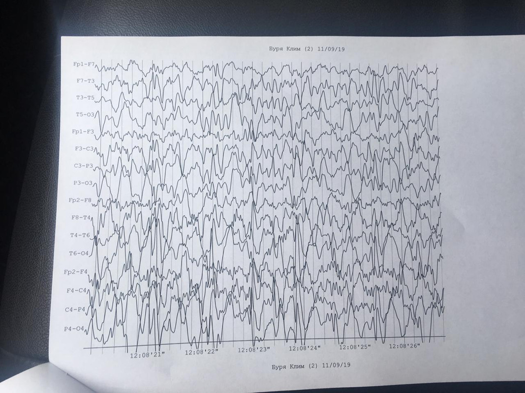 43A1962E-2E6C-44DD-B667-E8496079D581