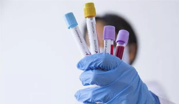 Türkiye’de koronavirüs testini yapanlar sonuçları E-devlet üzerinden öğrenebilirler.