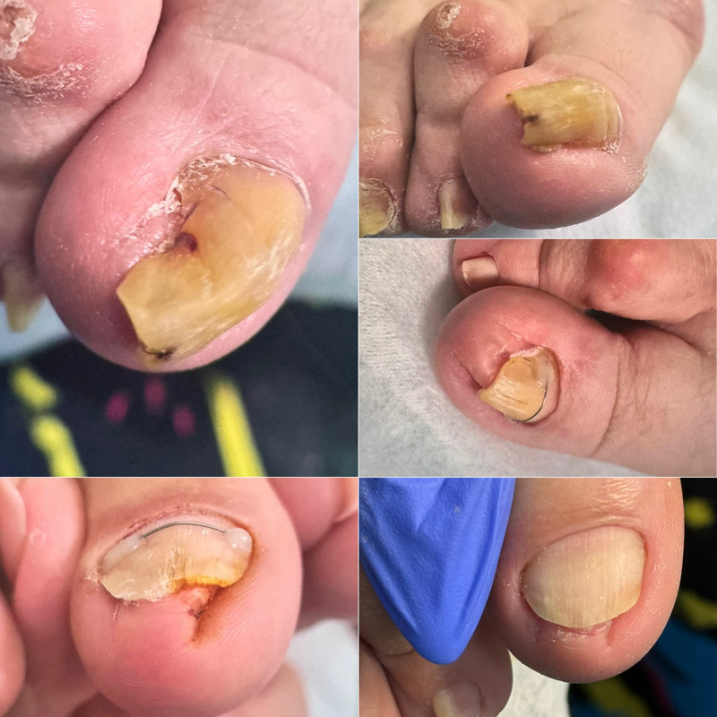 подология 1