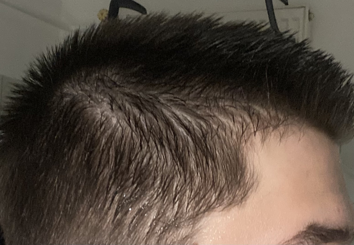 AD2F3BDE-9B1C-45F9-BF6C-FCD3EA83F5B9