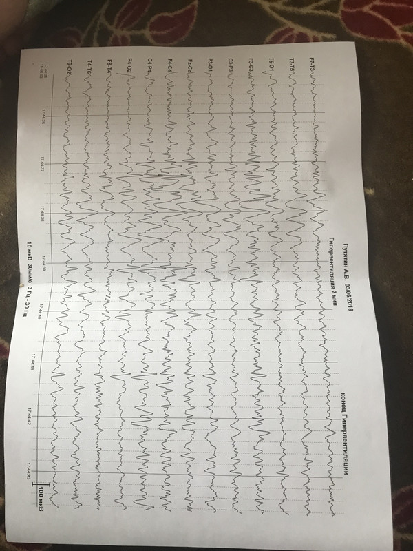 48CC3ABC-DDAE-4BD7-8068-1AE64CBC206A