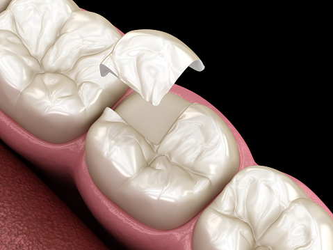 Dentist examining dental crown structures