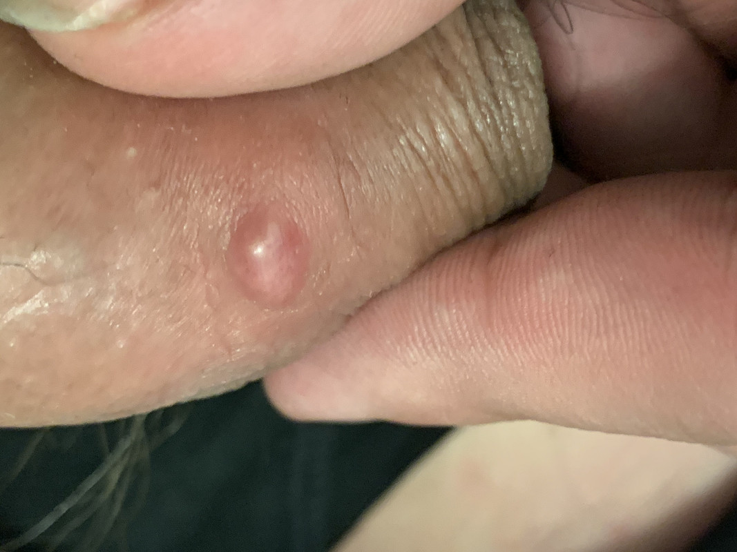 85A0F7E0-431D-4EEA-BEE8-179AB64B74E2