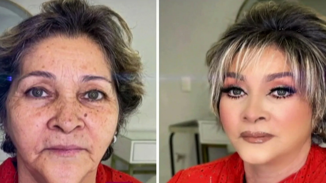 ¿Rejuvenecer sin cirugía? Prueba el maquillaje con hilos tensores