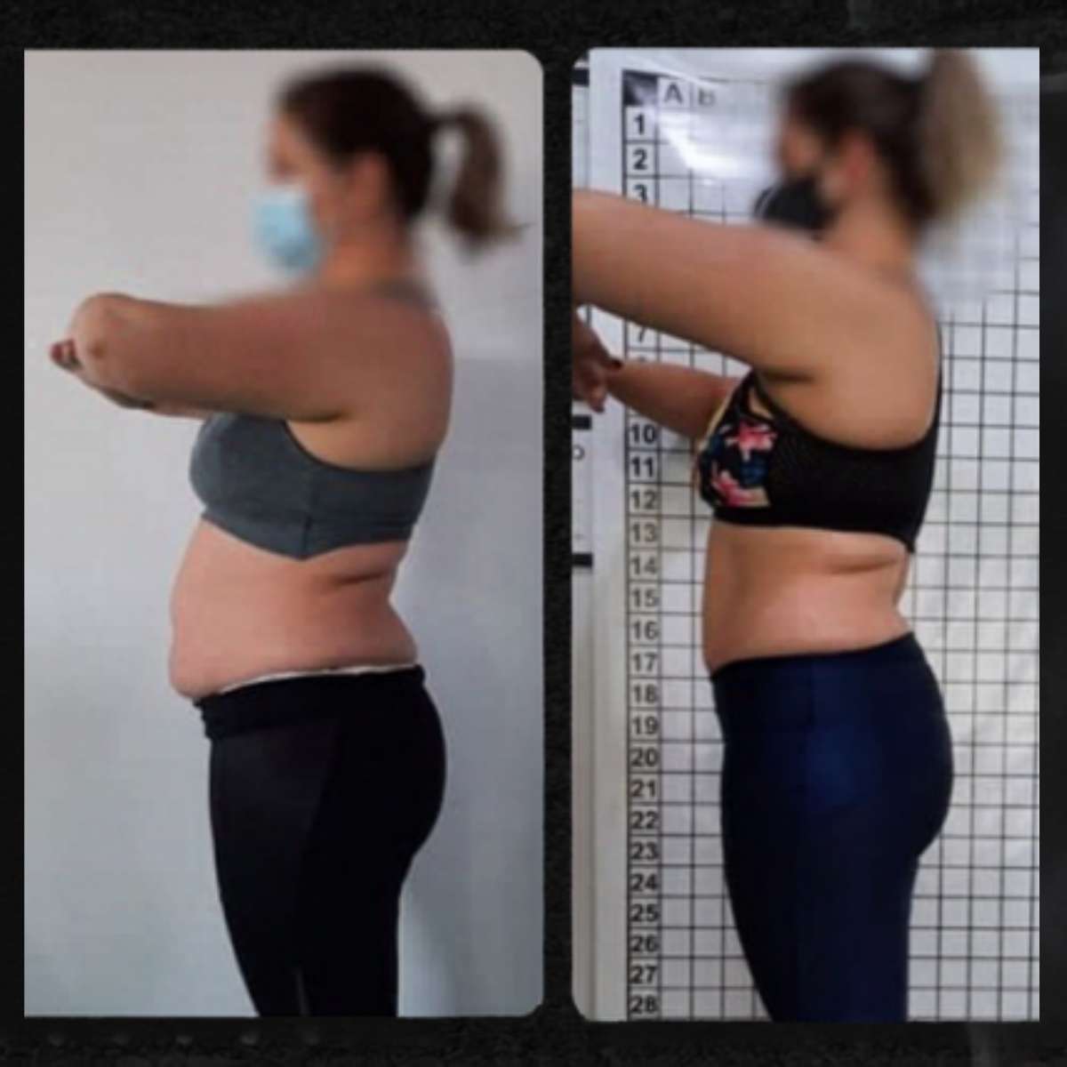 Antes e depois com ExxDrene HD 3