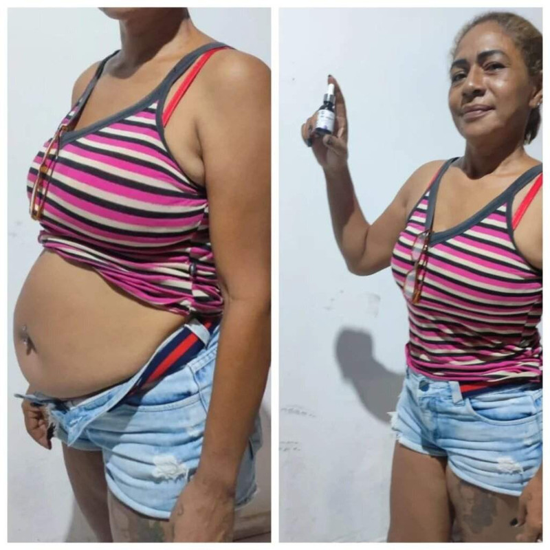 Antes e depois ilustrativo com uso de Mounjax