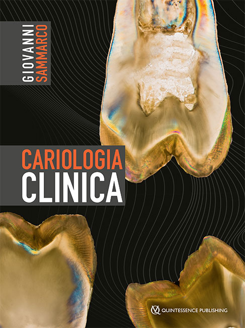 Cariologia clinica