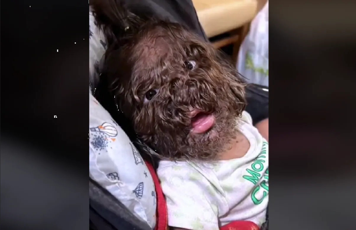 Niña con vello en el rostro se vuelve viral TikTok