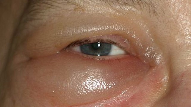 Infectious Diseases question 3 image