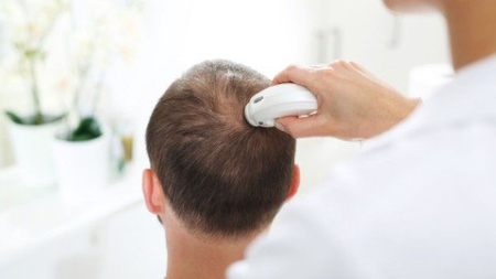 Hair Therapies (Trichology)