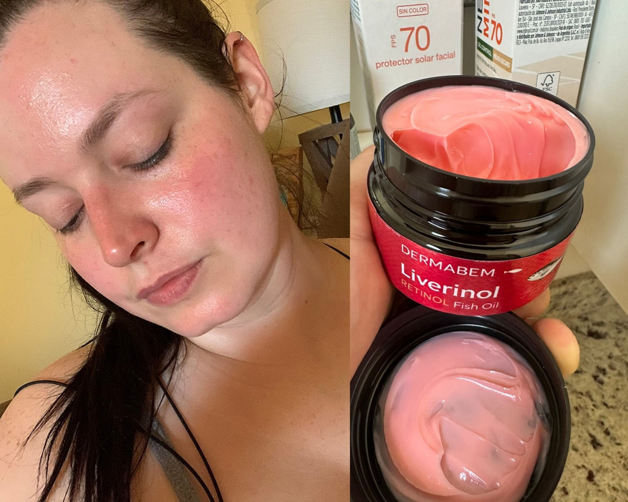 Antes e depois — Liverinol