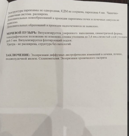узи2