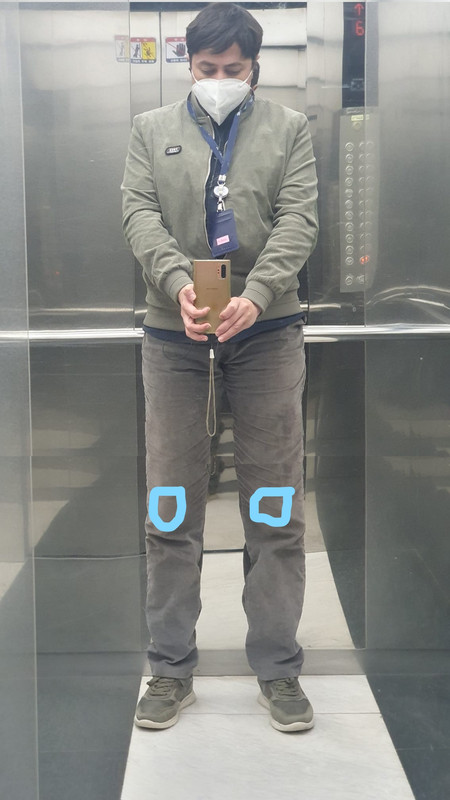 Do I look normal?