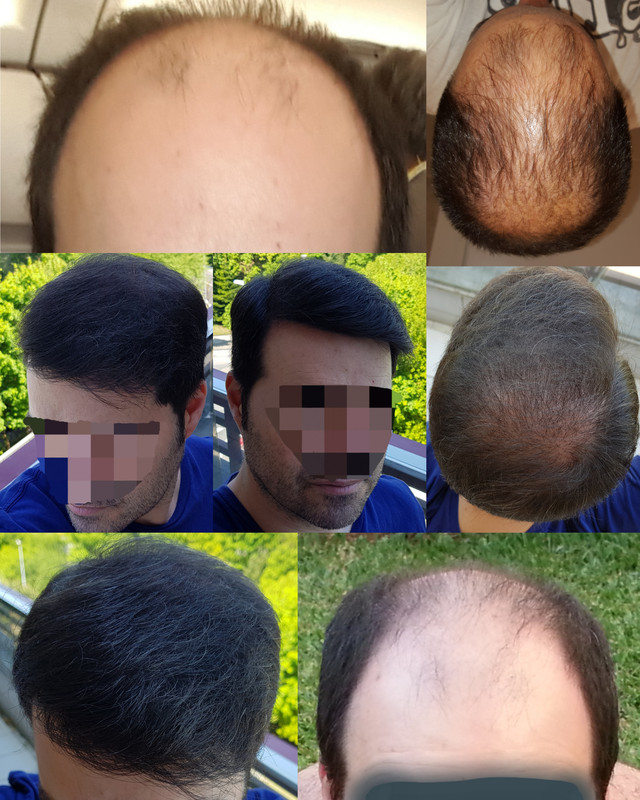CollageMaker_20180508_193726475