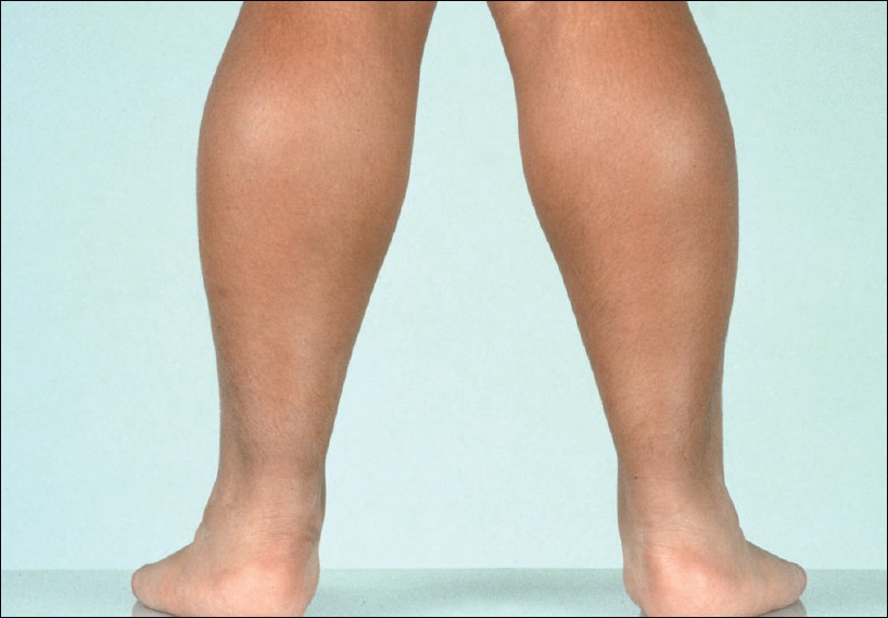 Neurology question 9 image