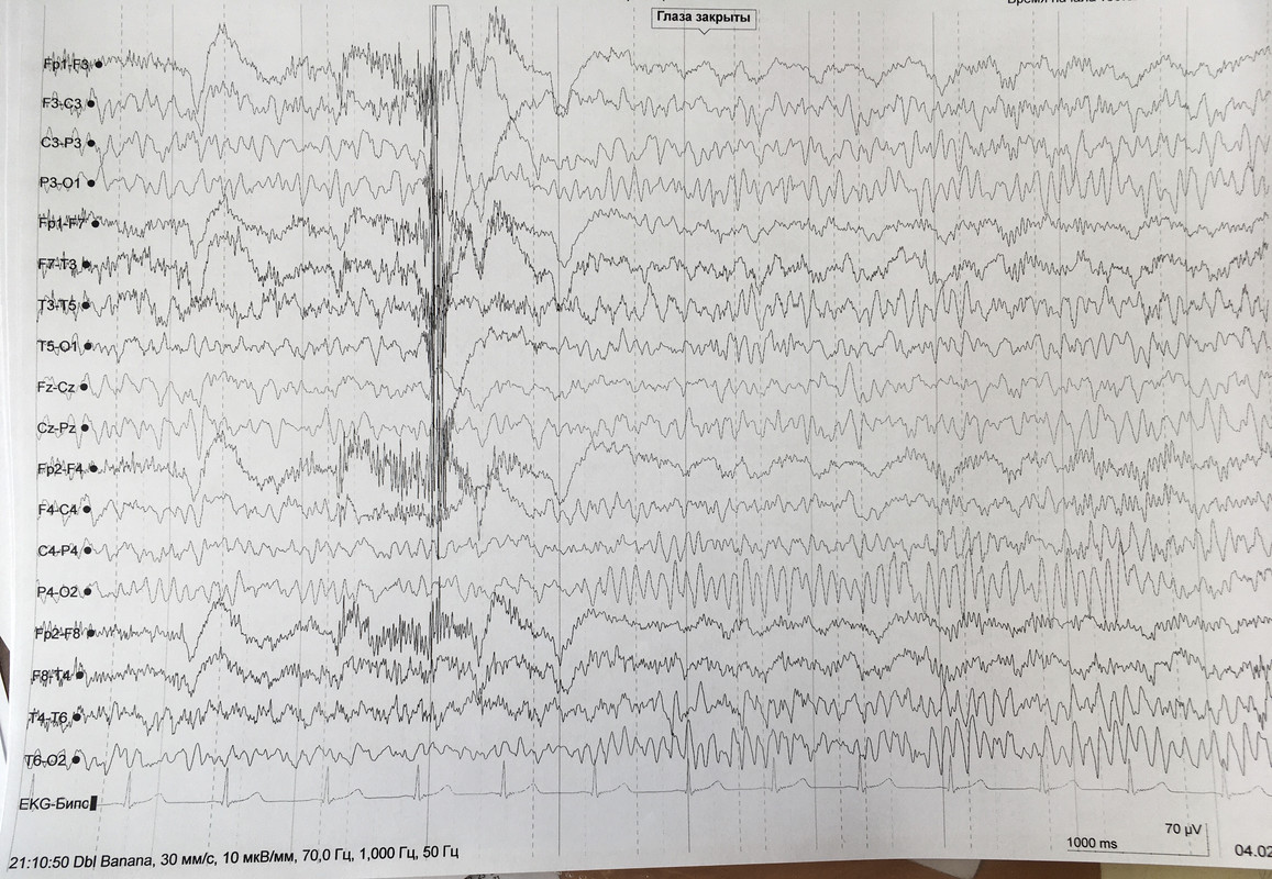 1B858D91-CA15-417E-A007-81F577C3DE6E