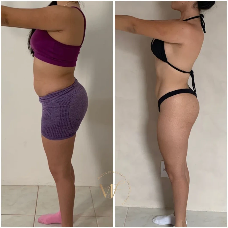 Before and after transformation 3