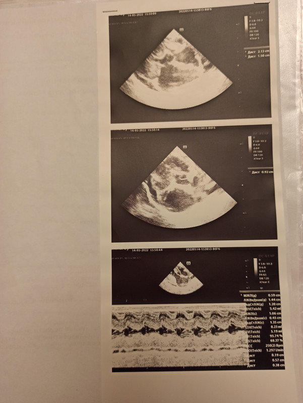 14.05.2022 УЗИ 2 сердце постановка диагноза