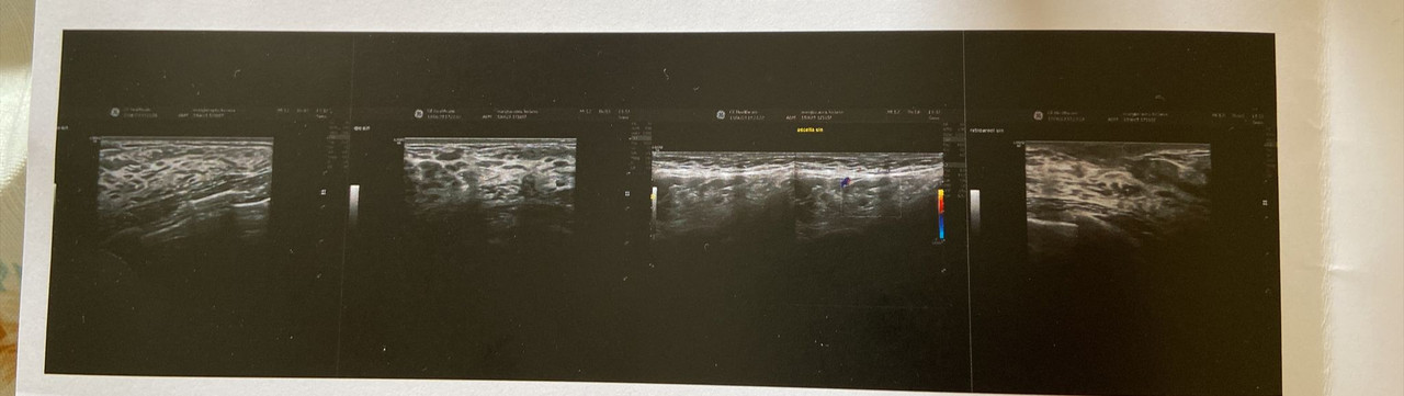 1DFFB68C-88B9-4587-8FAD-679CC2EFCE40