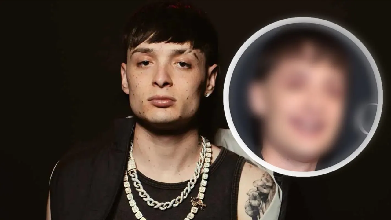 Peso Pluma cambia de look; le llueven burlas y criticas ¿Está chimuelo?