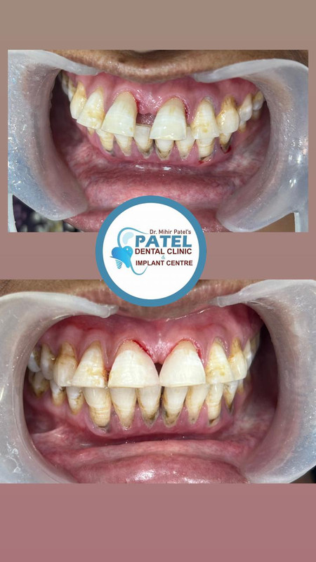 Patel Dental Clinic - Professional dental setup