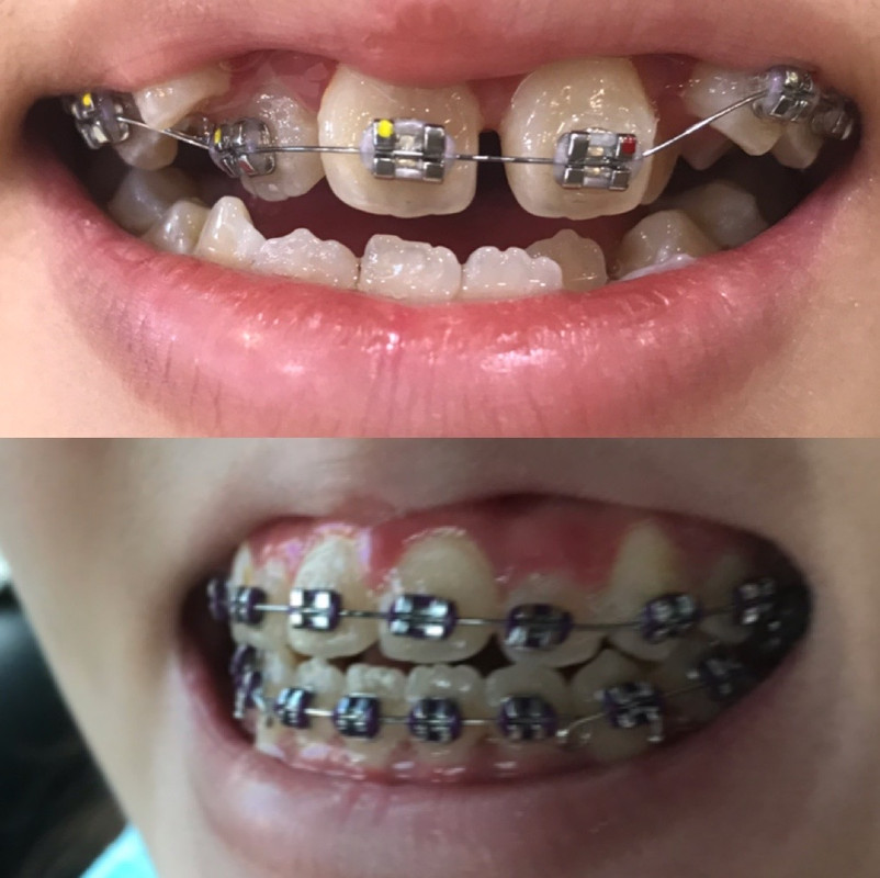 B3D450A0-22DE-44A3-8E89-EFFB6909117E