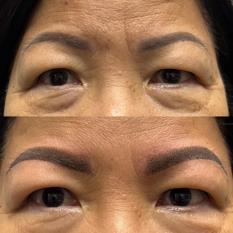 Eyebrow Enhancement Example 13